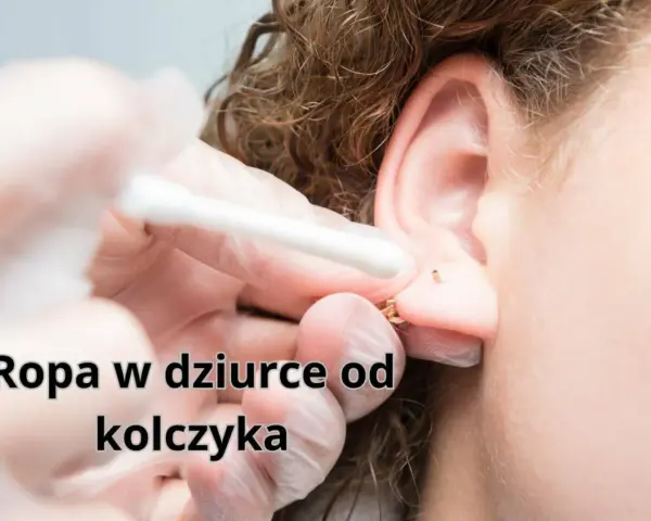 Ropa w dziurce od kolczyka, widoczna podczas czyszczenia ucha wacikiem.