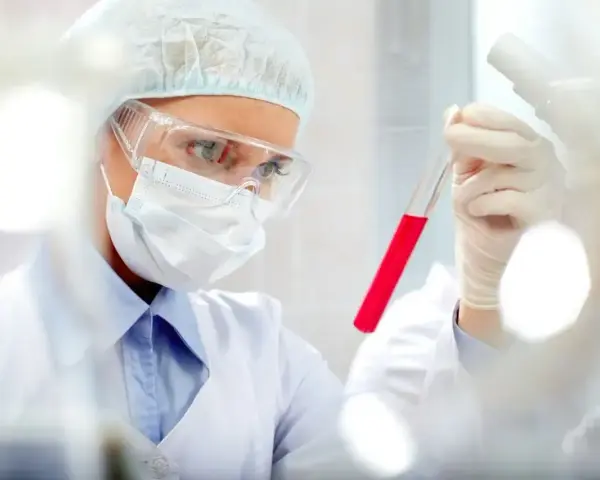 Naukowczyni w okularach i masce analizuje próbówkę z czerwonym płynem, badając poziom prokalcytoniny.
