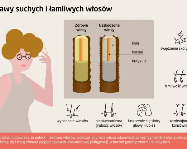Ilustracja pokazuje objawy suchych i łamliwych włosów, w tym rozdwojone końcówki i ogólne osłabienie struktury włosa.