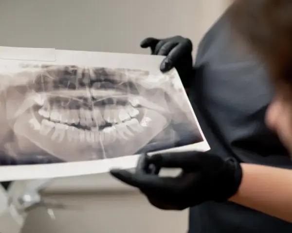 Pantomogram: Co dentysta widzi na zdjęciu? Ukryte problemy jamy ustnej