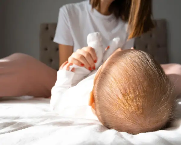 Ciemieniucha co to? Widok z góry na główkę niemowlaka z żółtawymi łuskami. Mama w tle.