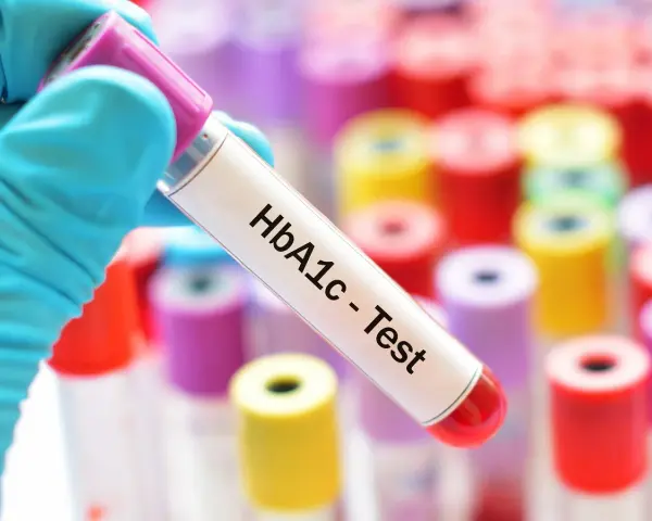 Ręka w niebieskiej rękawiczce trzyma probówkę z napisem "HbA1c - Test". W tle kolorowe probówki. Sprawdź, jaka jest hemoglobina glikowana cena.
