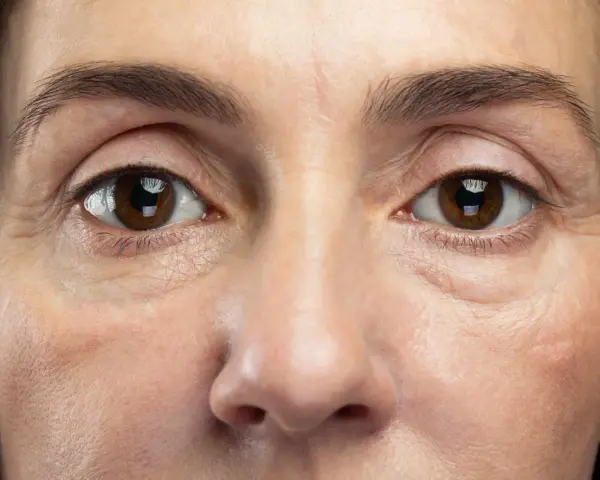 Nahaufnahme eines Gesichts, das schlaffe Haut unter den Augen zeigt, mit feinen Linien und Falten, die die Spuren der Zeit erzählen.