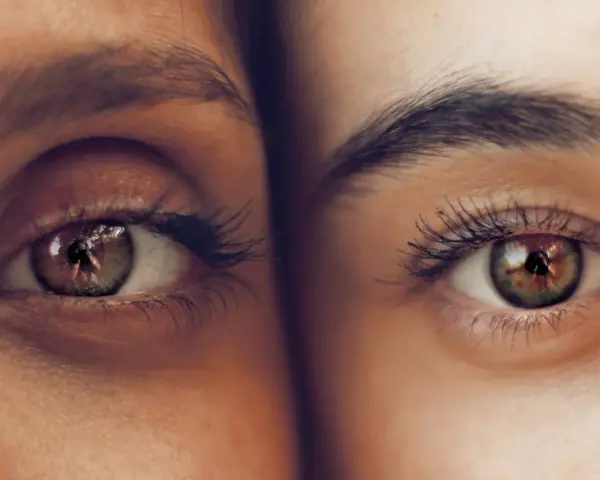 Dos ojos de cerca, uno con ojeras vasculares marcadas, el otro con piel lisa. Reflejos en los iris.