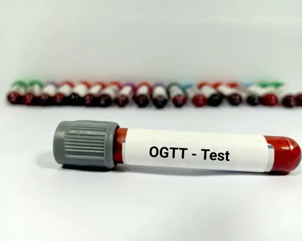 Probówka z oznaczeniem "OGTT - Test" na tle rzędu innych próbek. Wyniki tego testu pozwalają ocenić krzywą cukrową.