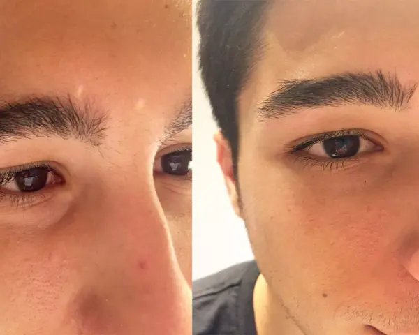 Antes y después de hacerse las cejas hombre. Las cejas se ven más definidas y limpias.