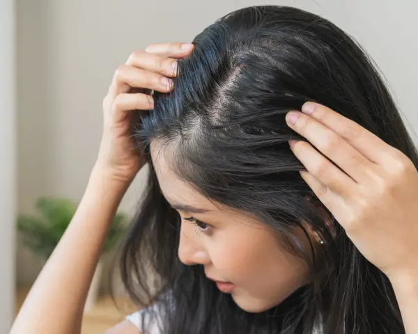 Kobieta dotyka swoich włosów, które wydają się przerzedzone. Widać delikatne baby hair przy skórze głowy.