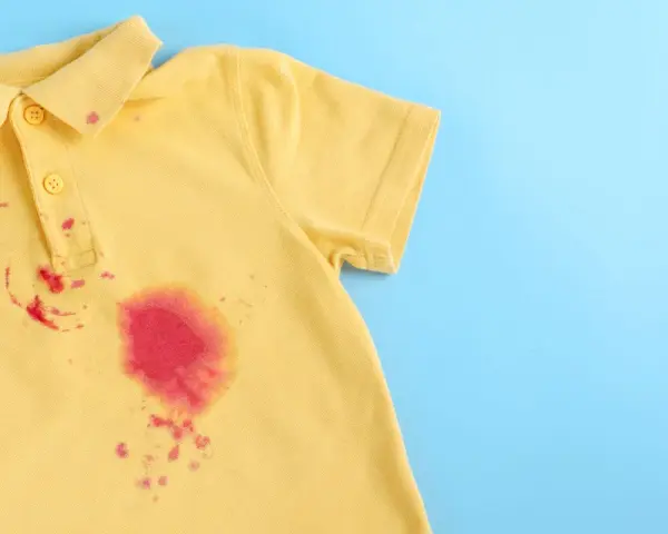 Gelbes Poloshirt mit roten Flecken, die nach dem Entfernen von Kleidung suchen.
