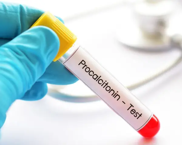 Ręka w niebieskiej rękawiczce trzyma probówkę z napisem "Procalcitonin - Test". To ważny pct.