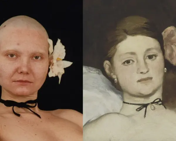 Dwie kobiety, jedna łysa z kwiatem we włosach, druga na obrazie inspirowanym Olimpia Manet.