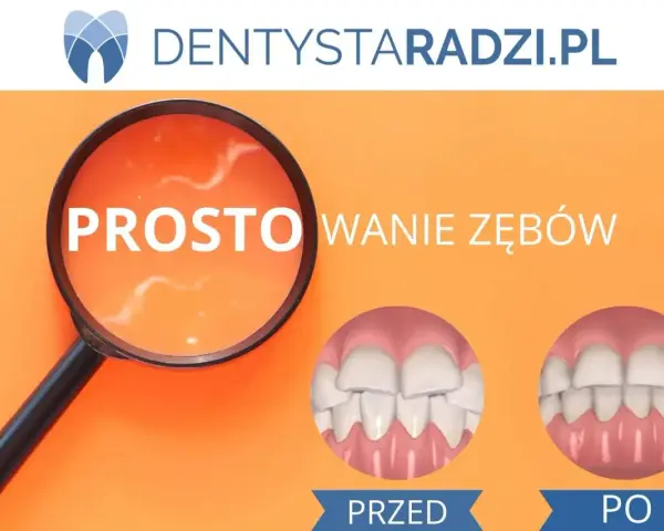 Prostowanie zębów domowymi sposobami: mity, ryzyko i alternatywy