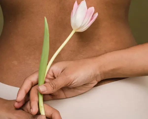Delikatne rozstępy na plecach, ukryte za tulipanem. Ciało w beżowej bieliźnie.