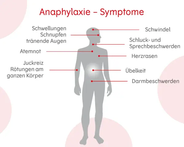 Allergie Symptome: So erkennen Sie gefährliche Reaktionen rechtzeitig