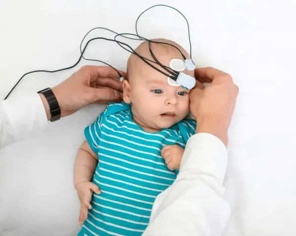 Niemowlę z elektrodami na głowie, przygotowywane do badania słuchu. To ważny krok w diagnostyce, by wcześnie wykryć potrzebę zastosowania aparatu słuchowego dla niemowlaka.