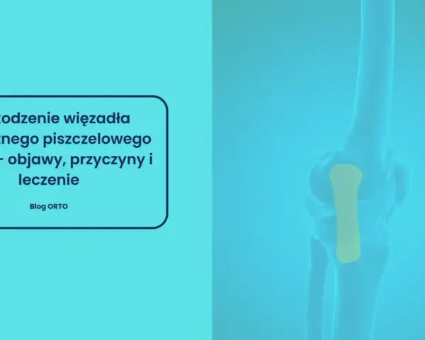 Anatomia kolana z zaznaczonym więzadłem pobocznym piszczelowym (MCL). Grafika informuje o uszkodzeniach, objawach i leczeniu.