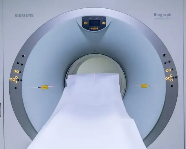 Tomograf komputerowy Siemens Biograph. Badanie może pomóc wykryć nerwiak nerwu słuchowego objawy.