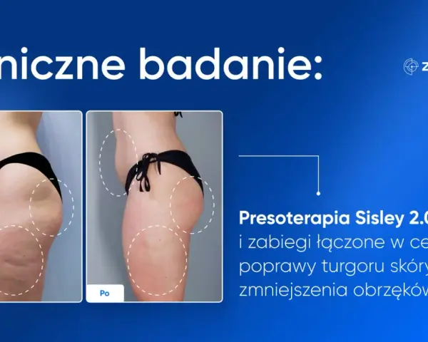 Przed i po zabiegu Presoterapia Sisley 2.0. Widoczna poprawa sylwetki dzięki mechanicznemu drenażowi limfatycznemu, redukcja obrzęków i cellulitu.