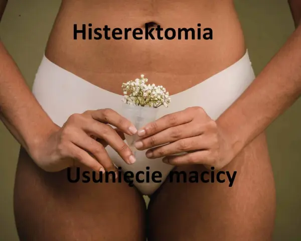 Kobieta trzyma kubeczek menstruacyjny z kwiatami. Napisy "Histerektomia" i "Usunięcie macicy" sugerują temat zabiegu.