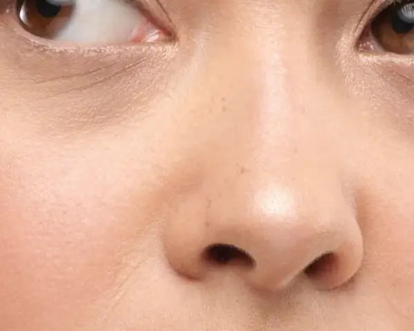 Nahaufnahme eines Gesichts mit braunen Augen und einer normalen Hautstruktur, die leichte Falten um die Augen zeigt.