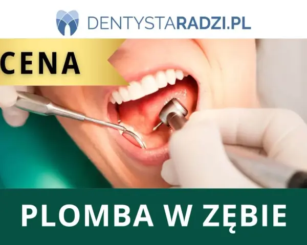 Ile kosztuje plomba światłoutwardzalna na nfz? Sprawdź, kto może skorzystać