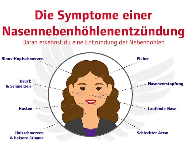 Nebenhöhlenentzündung Symptome: Erkennen Sie die Warnzeichen rechtzeitig