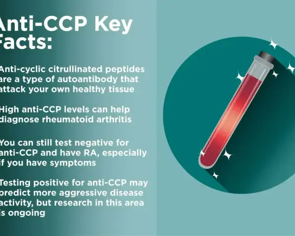 Kluczowe fakty o anty-CCP: przeciwciała atakujące tkanki, wysoki poziom anty-CCP pomaga diagnozować RZS. Test anty-CCP może przewidywać agresywność choroby.