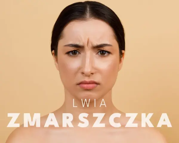 Kobieta z wyraźną lwia zmarszczka między brwiami. Dowiedz się, jak pozbyć się lwiej zmarszczki i odzyskać gładką skórę.