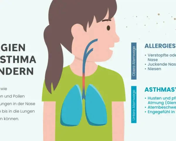 Illustration zeigt ein Kind mit Lungen und Atemwegen. Text erklärt Allergien und Asthma bei Kindern, Symptome wie Husten und Niesen.