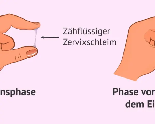 Hände zeigen Zervixschleim: zähflüssig in der Ovulationsphase, klumpig vor und nach dem Eisprung. Ein Einblick in den weiblichen Zyklus.