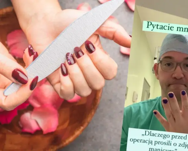 Paznokcie przed operacją? Lekarz w kitlu pokazuje pomalowane paznokcie, odpowiadając na pytanie, czy do operacji można mieć pomalowane paznokcie.