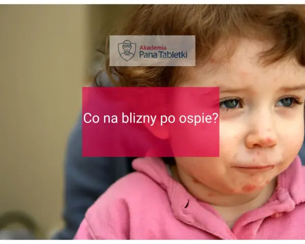 Twarz dziecka z widocznymi śladami po ospie. Napis "Co na blizny po ospie?" sugeruje poszukiwanie rozwiązań.