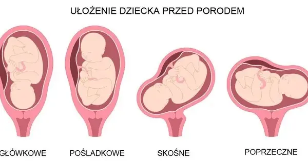 Kiedy dziecko obraca się główką w dół? Poznaj kluczowe informacje