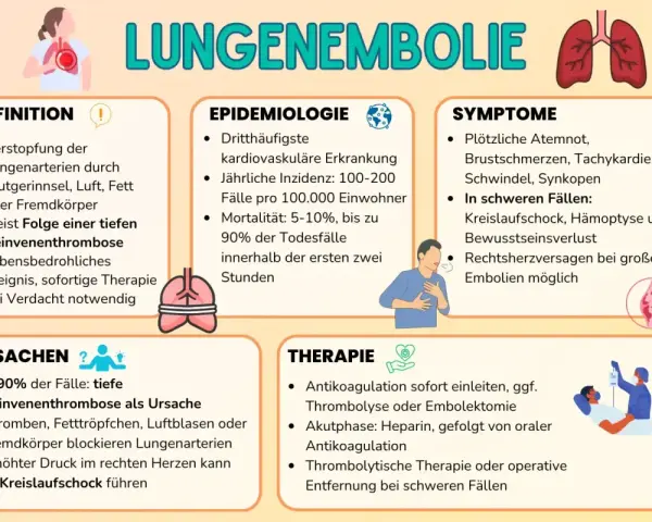 Infografik erklärt Lungenembolie: Ursachen (tiefe Beinvenenthrombose), Symptome (Atemnot, Schock) und Therapie. Eine doppelte Lungenembolie ist lebensbedrohlich.