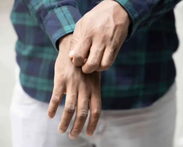 Uomo con camicia a quadri che si gratta il polso, soffrendo di prurito in tutto il corpo.