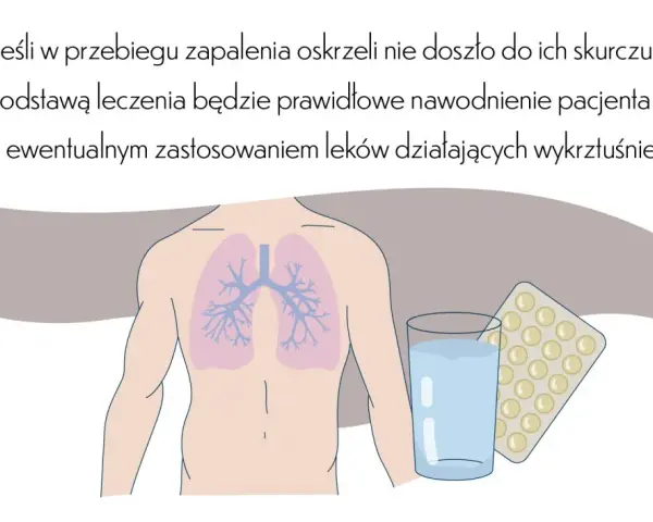Kiedy hospitalizować dziecko z zapaleniem oskrzeli? Objawy i porady
