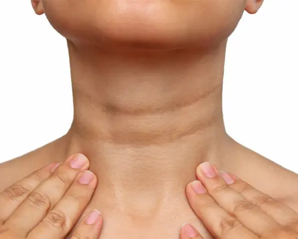 Cuello con piel oscura y arrugada, indicativo de acantosis nigricans. Se buscan opciones de tratamiento.