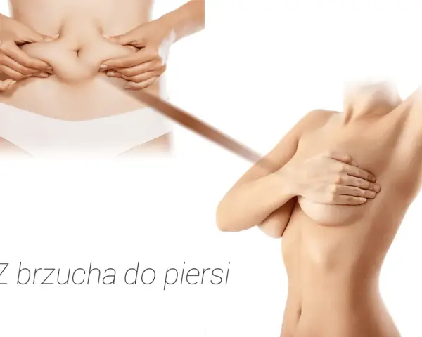 Przed i po: powiększenie biustu własnym tłuszczem opinie. Z brzucha do piersi.