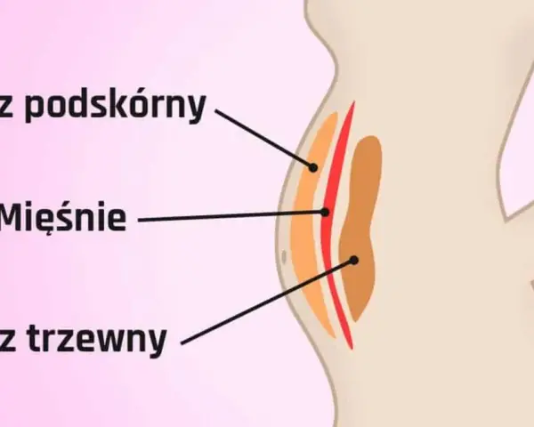 Ilustracja pokazuje przekrój brzucha, gdzie widać jak wygląda tłuszcz na brzuchu: podskórny i trzewny, oddzielone mięśniami.