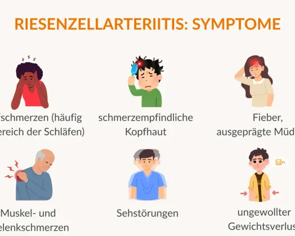 Symptome der Riesenzellarteriitis: Kopfschmerzen, schmerzempfindliche Kopfhaut, Fieber, Müdigkeit, Muskel-/Gelenkschmerzen, Sehstörungen, ungewollter Gewichtsverlust.