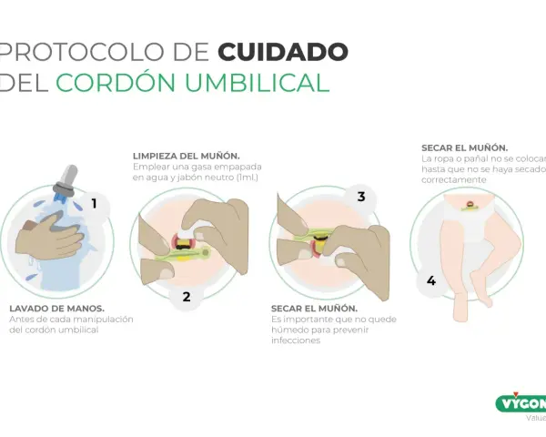 Guía para saber como limpiar el ombligo del bebe: lava manos, limpia el muñón con gasa y jabón neutro, sécalo bien para prevenir infecciones.