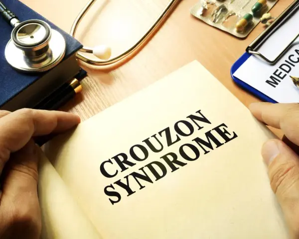Książka z napisem "CROUZON SYNDROME", stetoskop, dokument "MEDICAL HISTO" i lekarstwa.