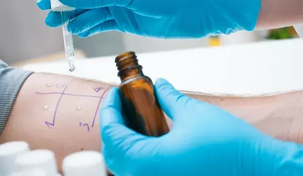 Na ile przed testami alergicznymi odstawić leki, aby uzyskać dokładne wyniki?