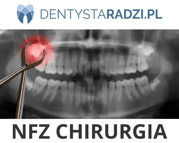 RTG szczęki z kleszczami dentystycznymi i zaznaczonym bólem. Gdzie wyrwać zęba w Łodzi na NFZ? NFZ Chirurgia.