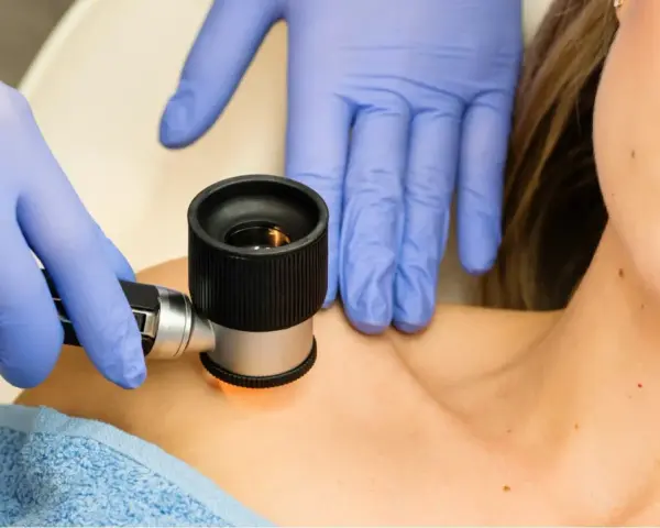 Dermatolog w niebieskich rękawiczkach wykonuje wideodermatoskopię znamion na szyi pacjentki.