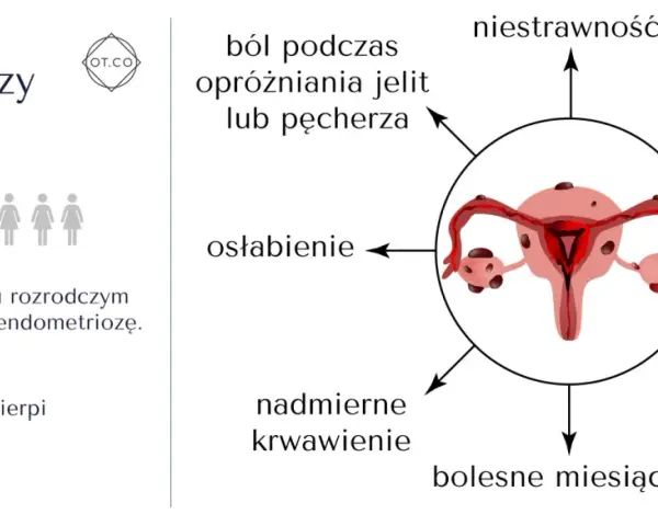 Objawy endometriozy: ból podczas owulacji, niestrawność, bezpłodność, mdłości, bolesny stosunek, bolesne miesiączki, nadmierne krwawienie, osłabienie, ból podczas opróżniania jelit lub pęcherza.
