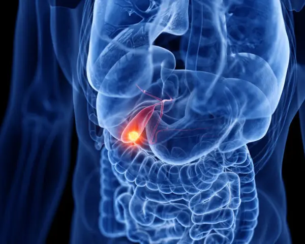 Anatomical rendering of a human torso showing the digestive system. A glowing yellow object, representing a gallstone, is visible within the **woreczek żółciowy**.