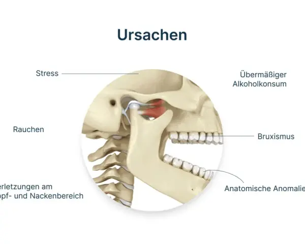 Kiefergelenk: Ursachen wie Stress, Rauchen, Bruxismus, Verletzungen, übermäßiger Alkoholkonsum und anatomische Anomalien. Physiotherapie Kiefergelenk was wird gemacht?