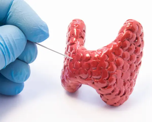 Ręka w niebieskiej rękawiczce wykonuje biopsję tarczycy, pobierając próbkę z czerwonego modelu gruczołu.