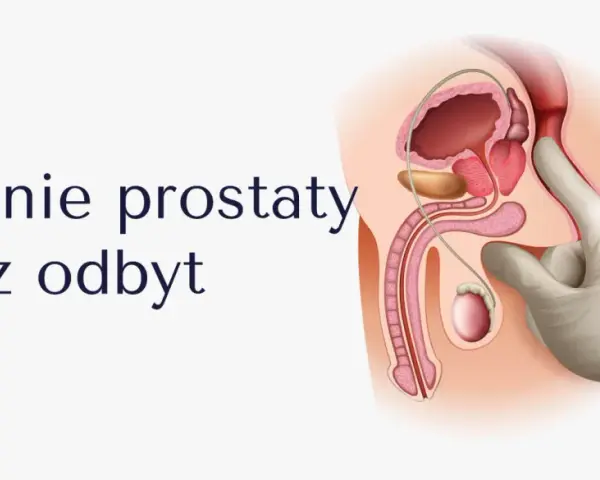 Ilustracja anatomiczna męskiego układu rozrodczego z badaniem per rectum.