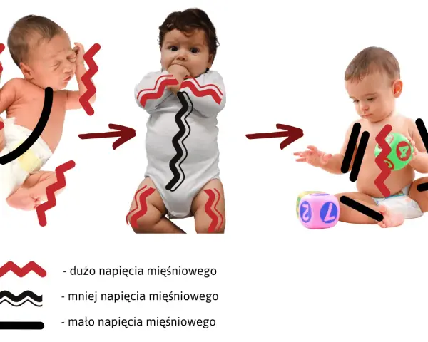 Dziecko sie napina, od noworodka z dużym napięciem, przez niemowlę z mniejszym, do starszego dziecka z minimalnym napięciem.